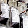 Blood Bag Labels For Medical Industry - Image 3