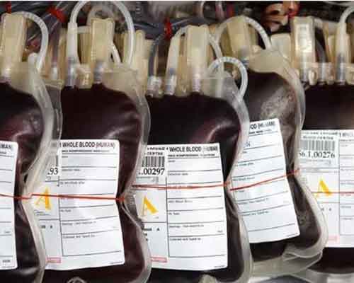 blood-bag-labels Cryogenic Blood Bag Label